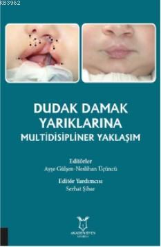 Dudak Damak Yarıklarına Multidisipliner Yaklaşım Ayşe Gülsen Teker