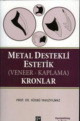 Metal Destekli Estetik (Veneer - Kaplama) Kronlar Hüsnü Yavuzyılmaz